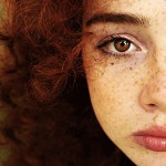 Kako se riješiti frecklesa? Kako se riješiti frecklesa?