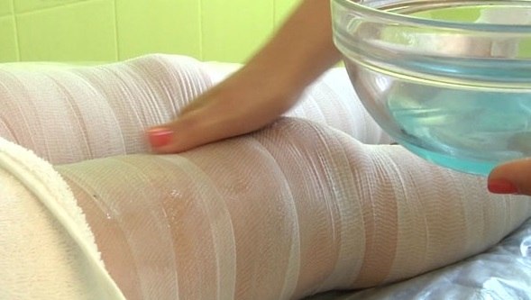 Liječenje ateroskleroze kod narodnih lijekova