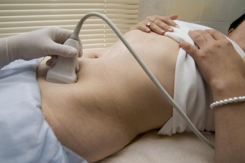 Bazalna temperatura tijekom trudnoće