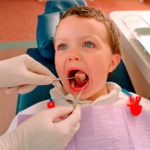 Kako liječiti stomatitis