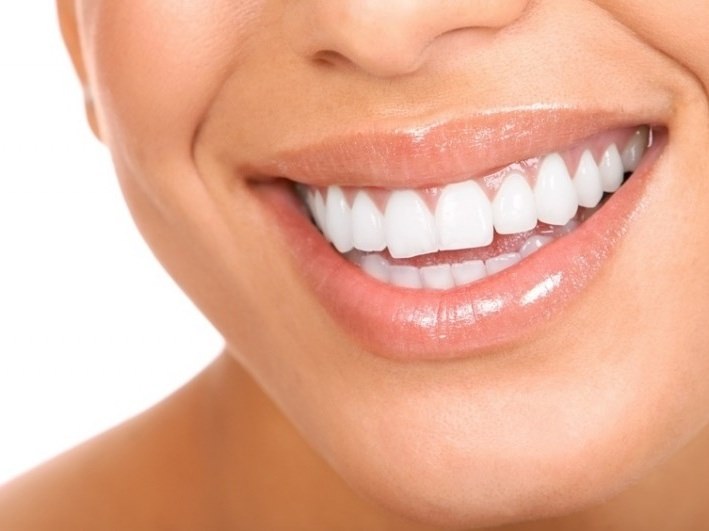 Je li moguće zubi čak i bez upotrebe proteza?